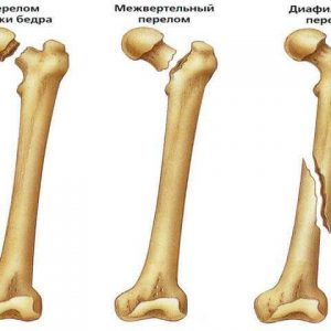 Перелом бедра / таза у кота